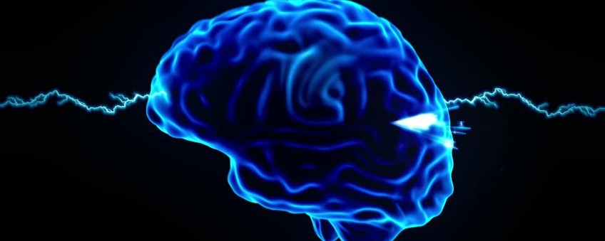 Drupal accessibility brain Drupal accessibility brain